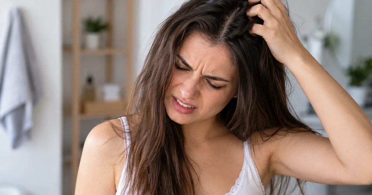 Dermatite seborreica pode exigir mais do que lavar o couro cabeludo
