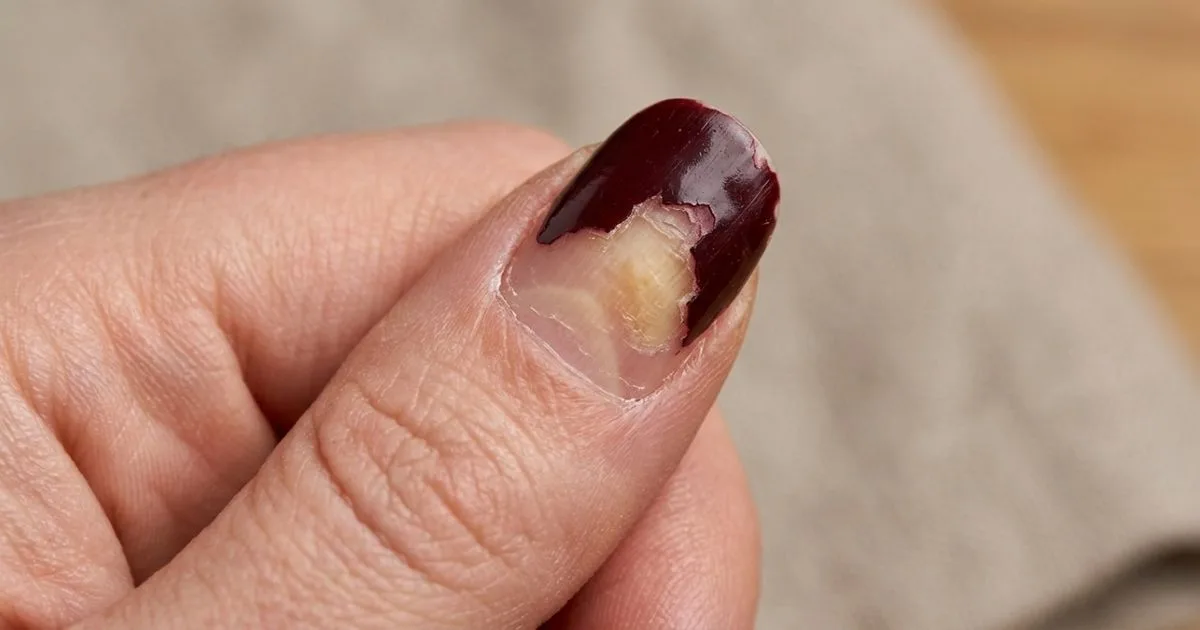 Como evitar que o esmalte descasque no dia seguinte