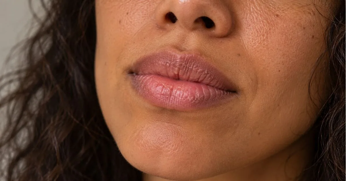 Por que os lábios seguem secos mesmo com o uso de balm